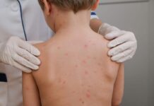 Sobe para oito o número de mortes por meningite em Mato Grosso